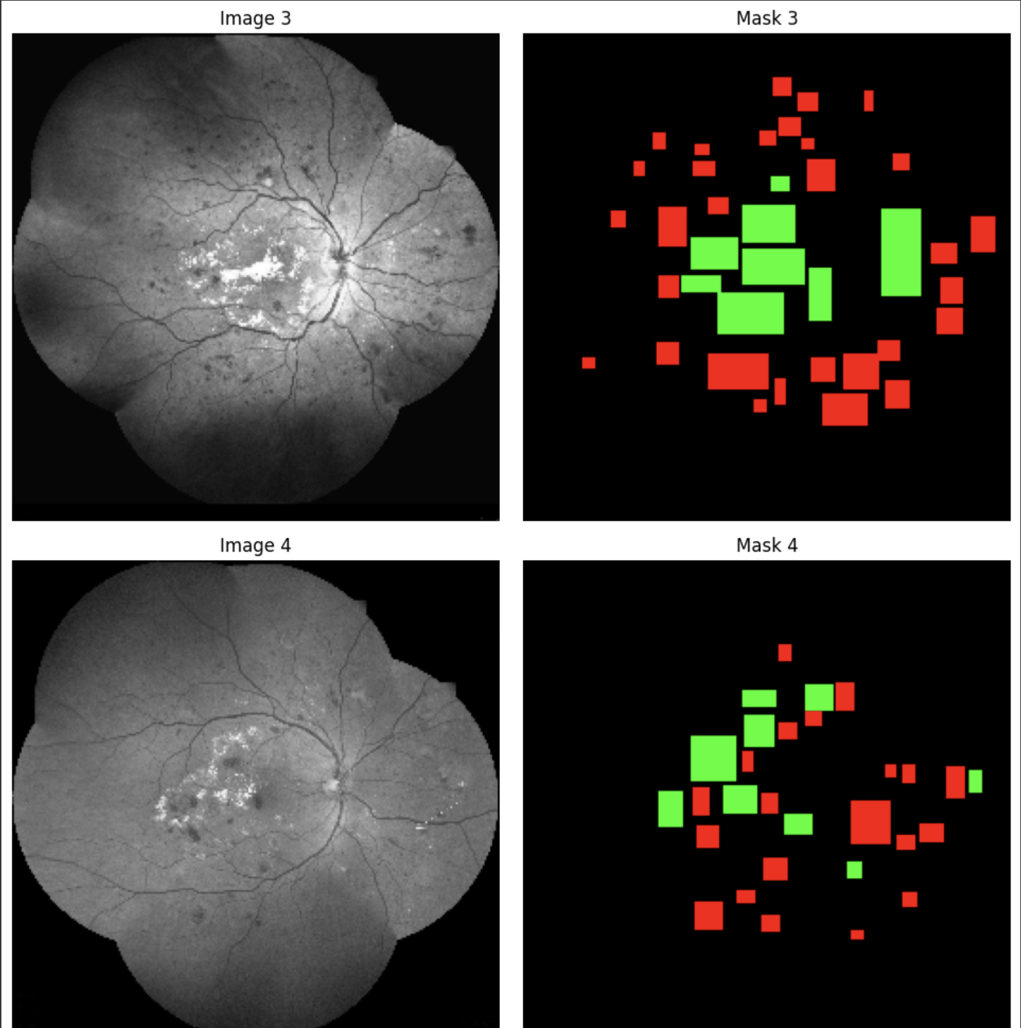 Fig. 4: Vizualisation of ground truth masks (in green exudates and in red hemorrhages)